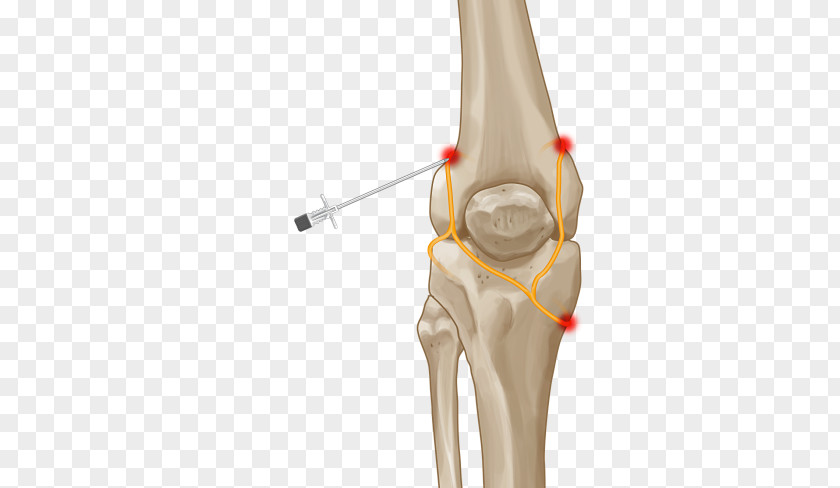Muscle Pain Thumb Knee Joint Nerve PNG