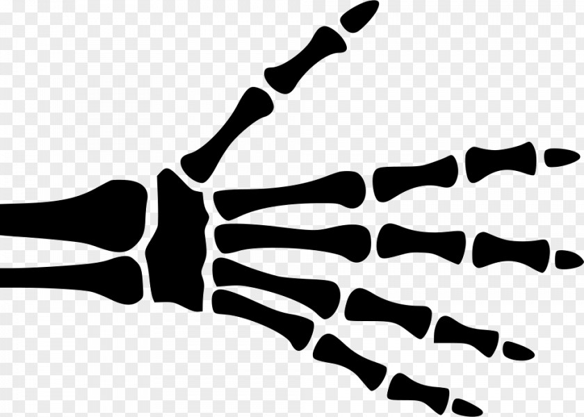 Hand Finger X-ray Carpal Bones PNG