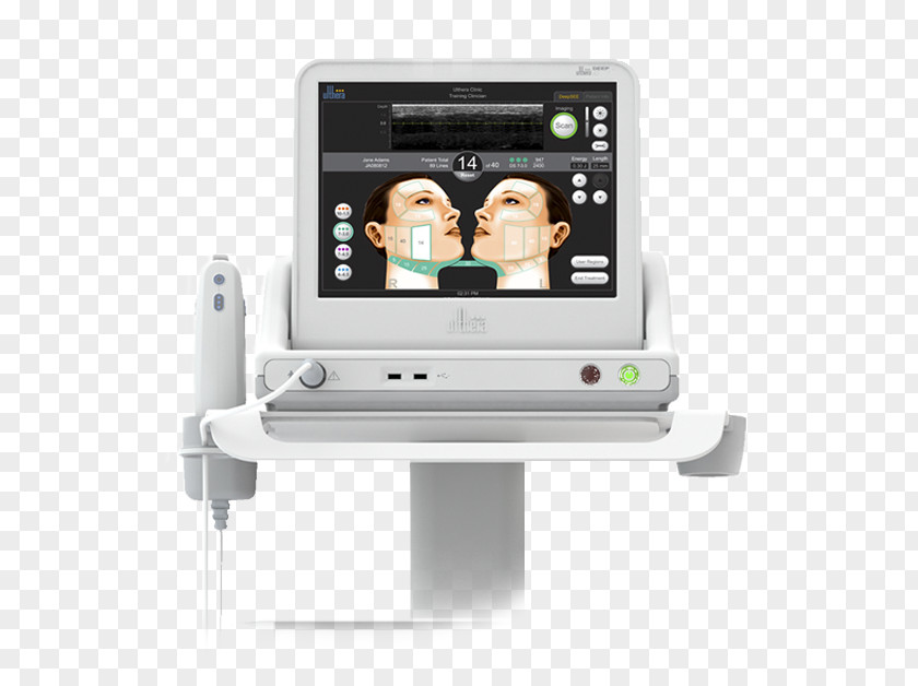 Face High-intensity Focused Ultrasound Surgery Skin Care Rhytidectomy PNG