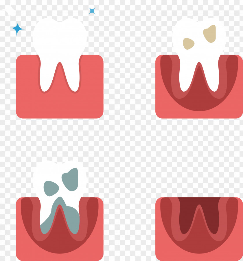Deterioration Of Teeth Tooth Euclidean Vector Computer File PNG