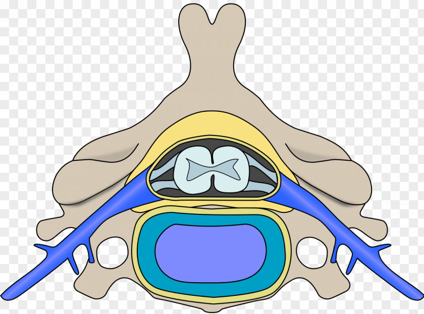Spinal Muscular Atrophy Cord Vertebral Column Muscle PNG