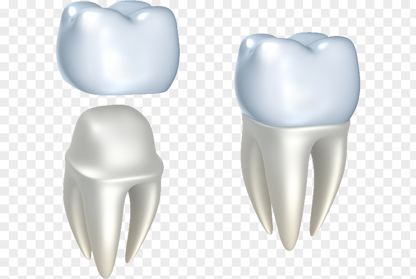 Restorative Dentistry Crown Cosmetic Dental Restoration PNG