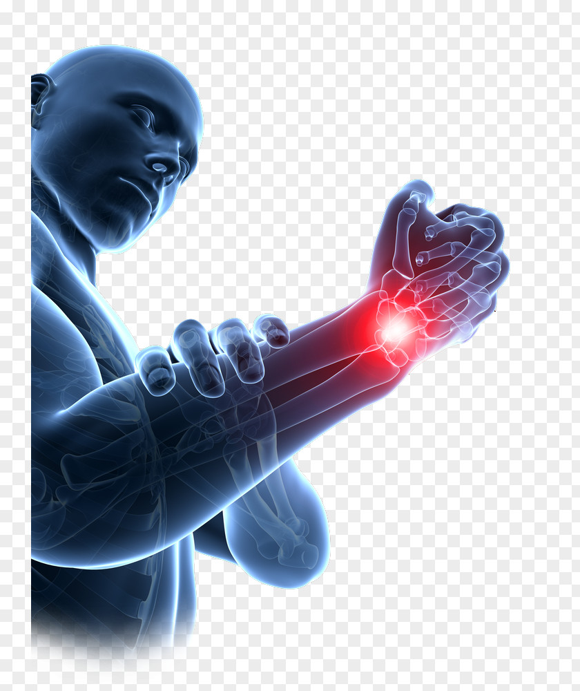 Hand Repetitive Strain Injury Carpal Tunnel Syndrome Wrist Bones PNG