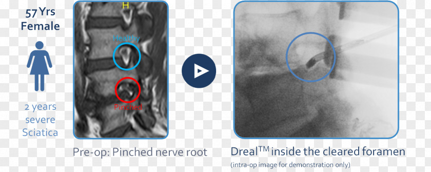 Technology Medical Equipment PNG