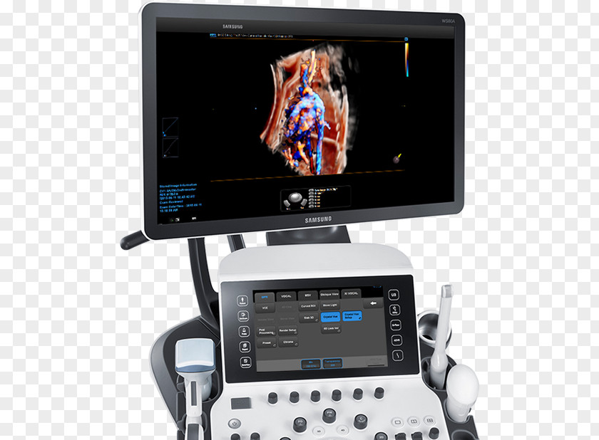 Ob Gyn Pics Ultrasonography Ultrasound Obstetrics And Gynaecology Radiology Medical Diagnosis PNG