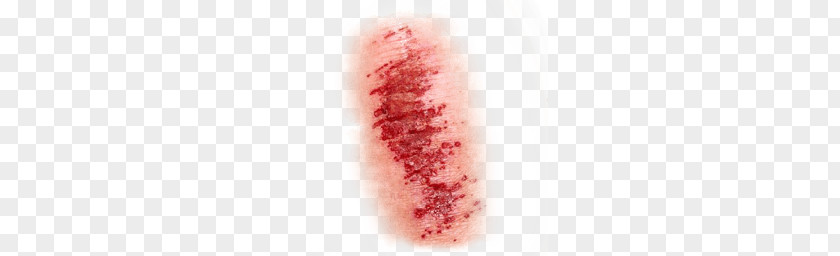 Light Wound PNG Wound, human skin condition clipart PNG
