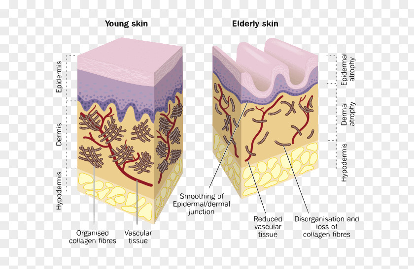 Corporate Elderly Care Collagen Skin Wrinkle Hyaluronic Acid Dermis PNG