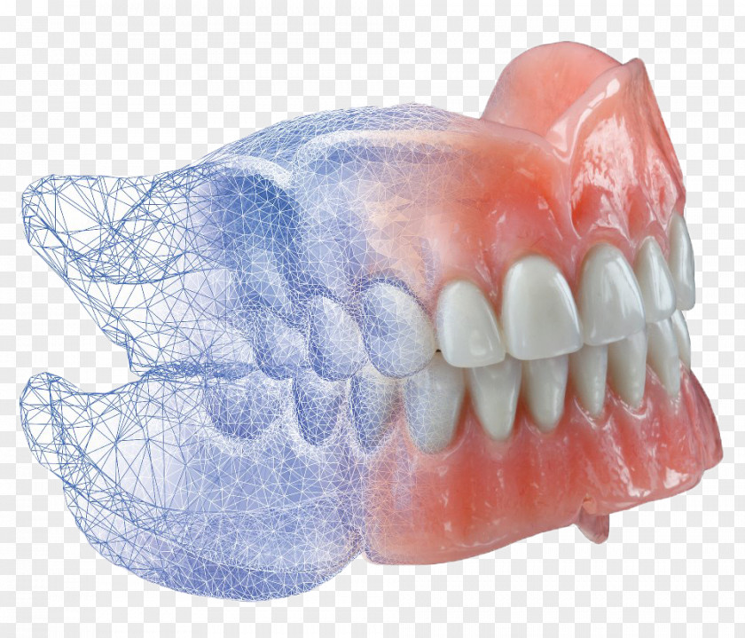Crowns AvaDent Dentures CAD/CAM Dentistry PNG