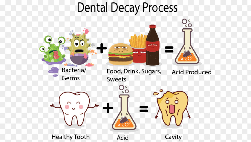 Dental Caries Tooth Decay Human Dentistry Enamel PNG
