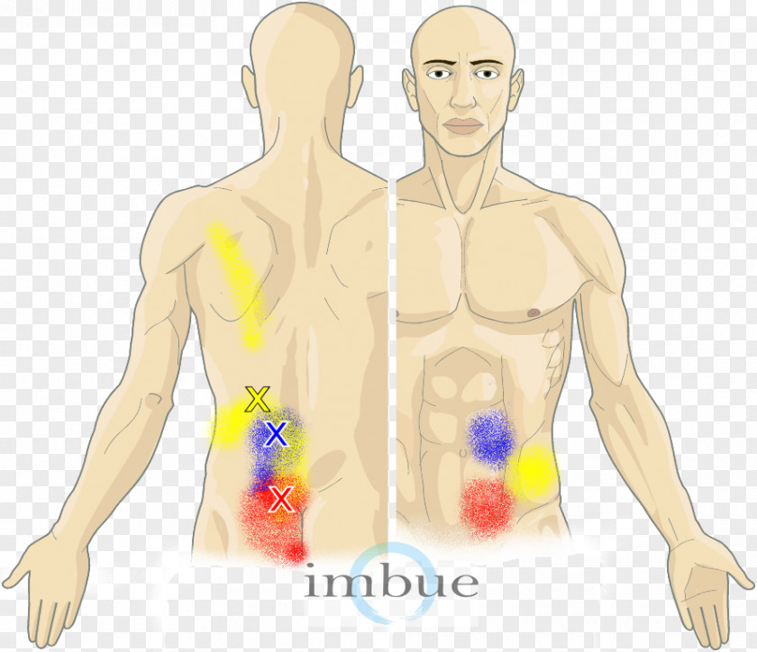 Muscle Pain Finger Abdomen Human Body Myofascial Trigger Point Abdominal PNG