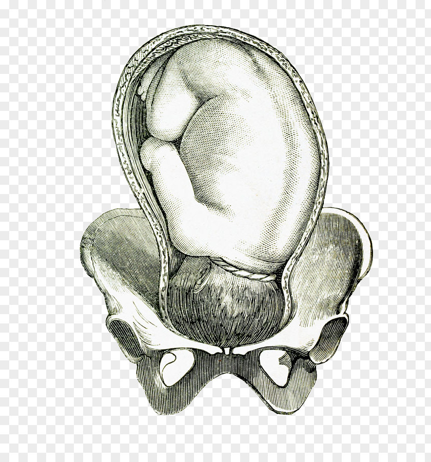 A Baby In Hand Drawn Embryo Umbilical Cord Prolapse Fetus Illustration PNG