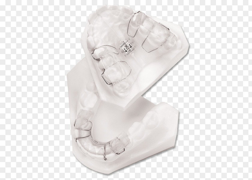 Twin Block Appliance Home Bionator Retainer Open Bite Malocclusion PNG