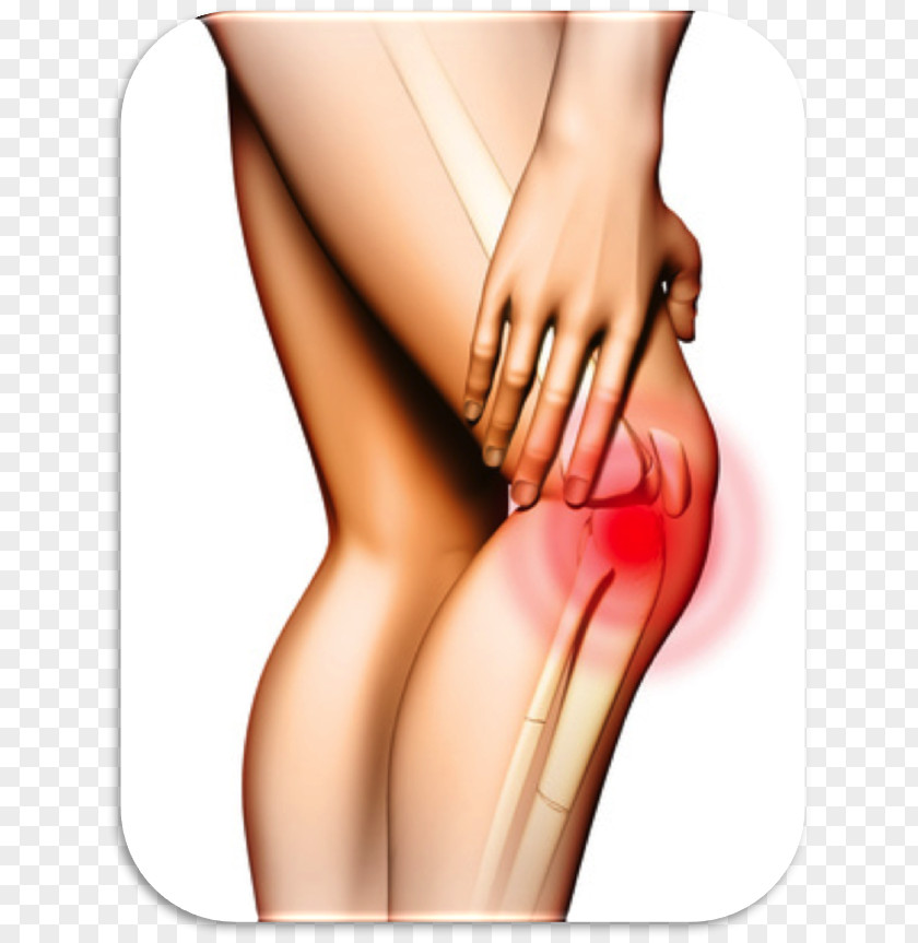 Health Knee Pain Management Iliotibial Band Syndrome Healing PNG