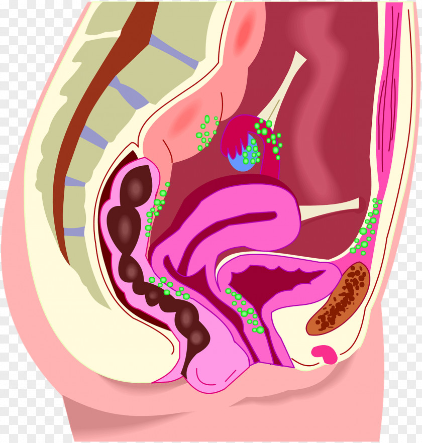 The Delicacy Menstruation Endometriosis Uterus Endometrium Disease PNG