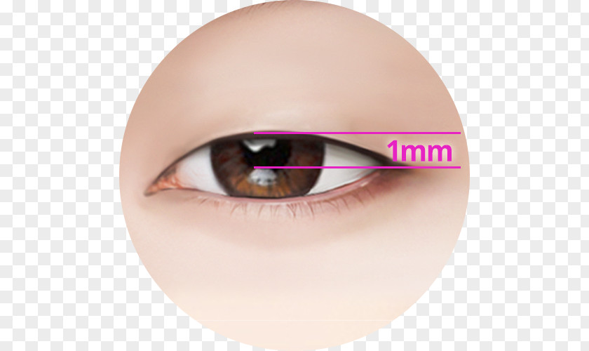 Eye Correction Ptosis Eyelid Surgery Intervenție Chirurgicală PNG