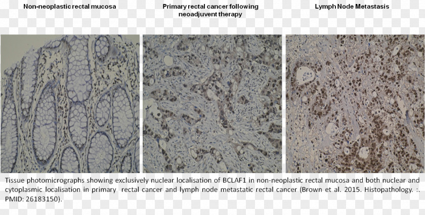 Programmed Cell Death Protein 1 Granite Material PNG