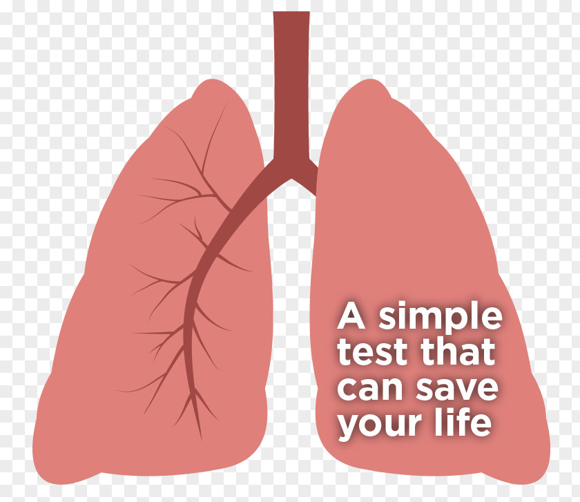 Lungs Surgery Lung Cancer Screening Thumb Computed Tomography PNG