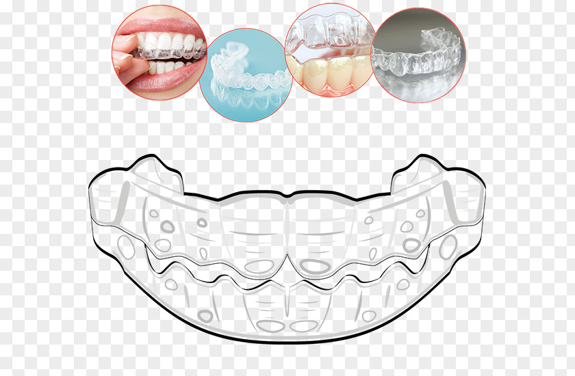 Invisalign Tooth Clear Aligners Orthodontics Therapy Mouth PNG