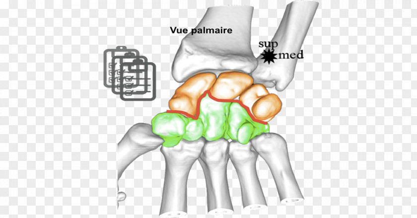 Thumb Carpal Bones Arthrology Wrist PNG