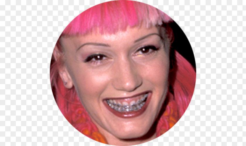 Mouth Smile Gwen Stefani Singer-songwriter Celebrity Dental Braces Plastic Surgery PNG