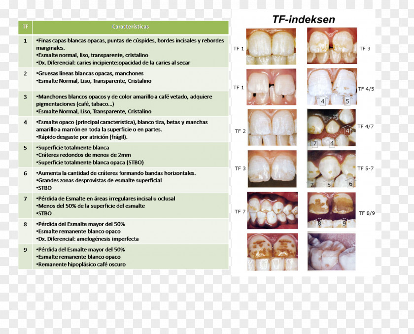 Indice Advertising Dental Fluorosis Dentistry Brochure PNG
