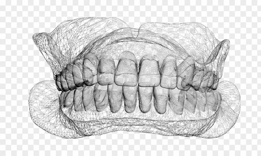 Overdentures Sketch Veneer PNG