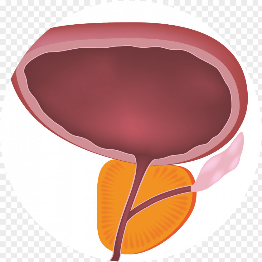 Prostate Benign Prostatic Hyperplasia Lower Urinary Tract Symptoms Benignity PNG