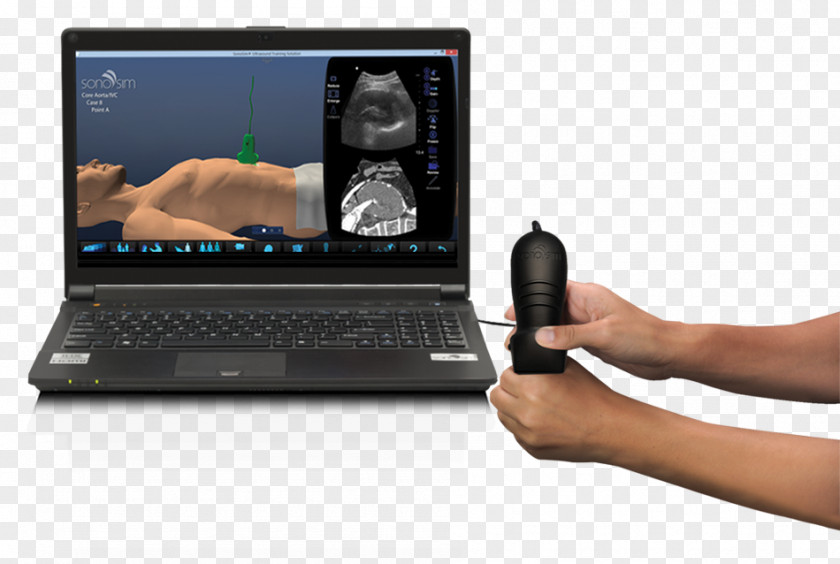 Laptop Netbook SonoSim Computer Hardware Personal PNG