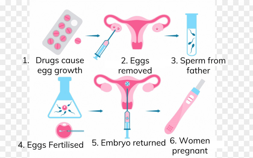 Pregnancy In Vitro Fertilisation Assisted Reproductive Technology Human Fertilization PNG