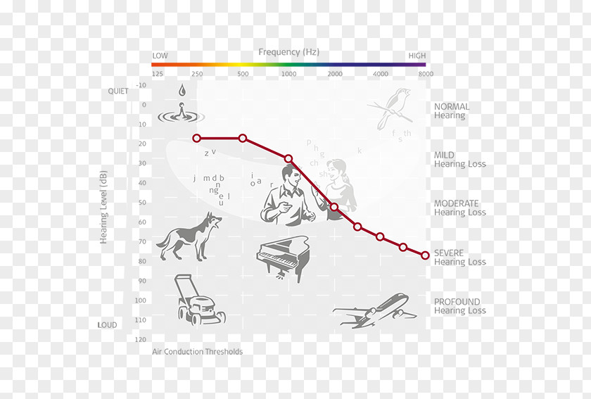 Ear Cochlear Implant Audiometry Audiogram MED-EL Hearing Loss PNG