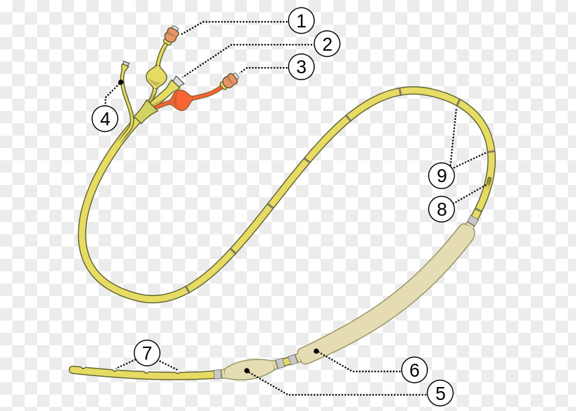 Esophagus Sengstaken–Blakemore Tube Upper Gastrointestinal Bleeding Balloon Tamponade PNG