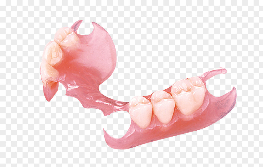 Partial Removable Denture Dentures Dentistry Crown PNG
