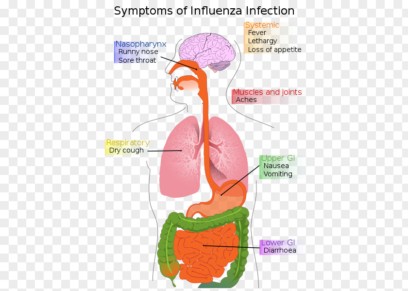 Pig Swine Influenza 2009 Flu Pandemic Influenza-like Illness PNG