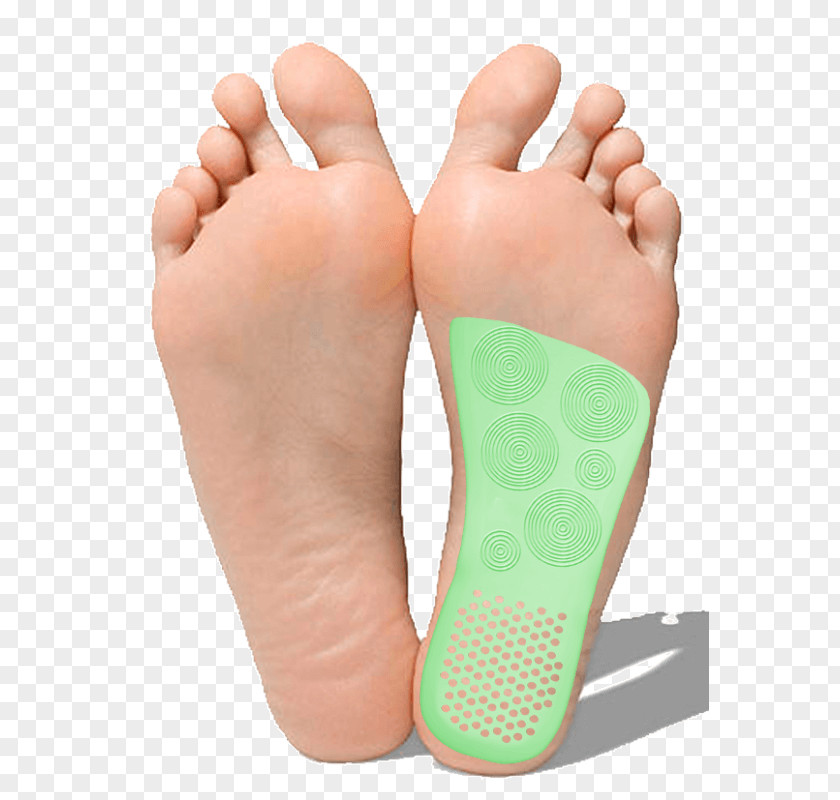 Podalgia Diabetic Foot Flat Feet Skin Ulcer PNG