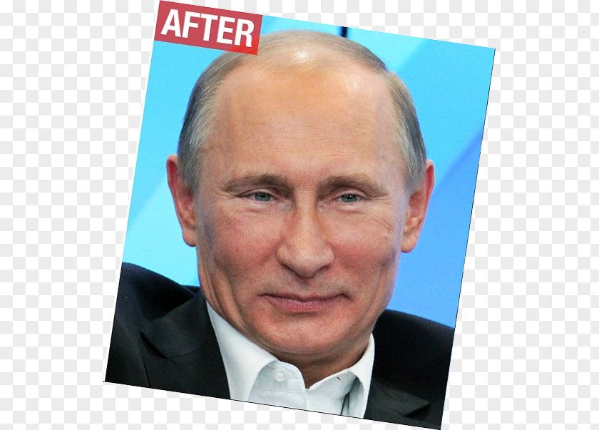 Vladimir Putin President Of Russia Surgery PNG