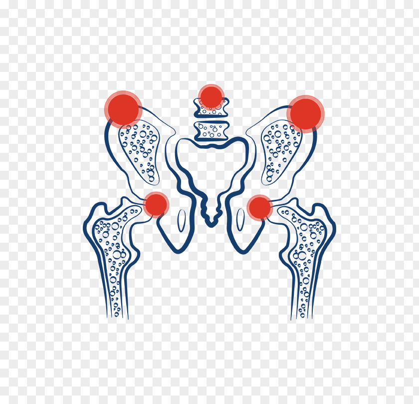 Osteoporosis Pakistan Organism Computer Servers Clip Art PNG