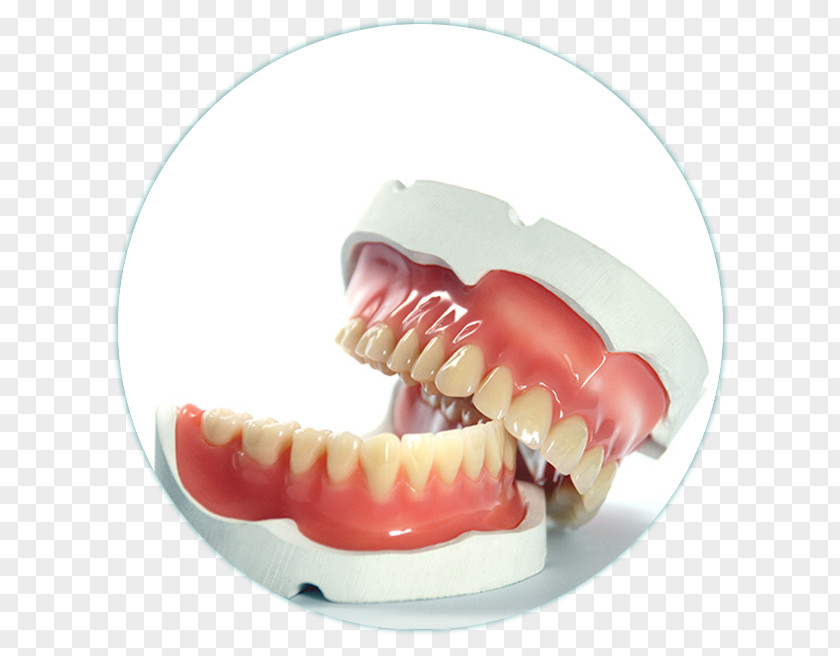 Cirurgia Dentista Dentures Prosthesis Dentistry Tooth PNG