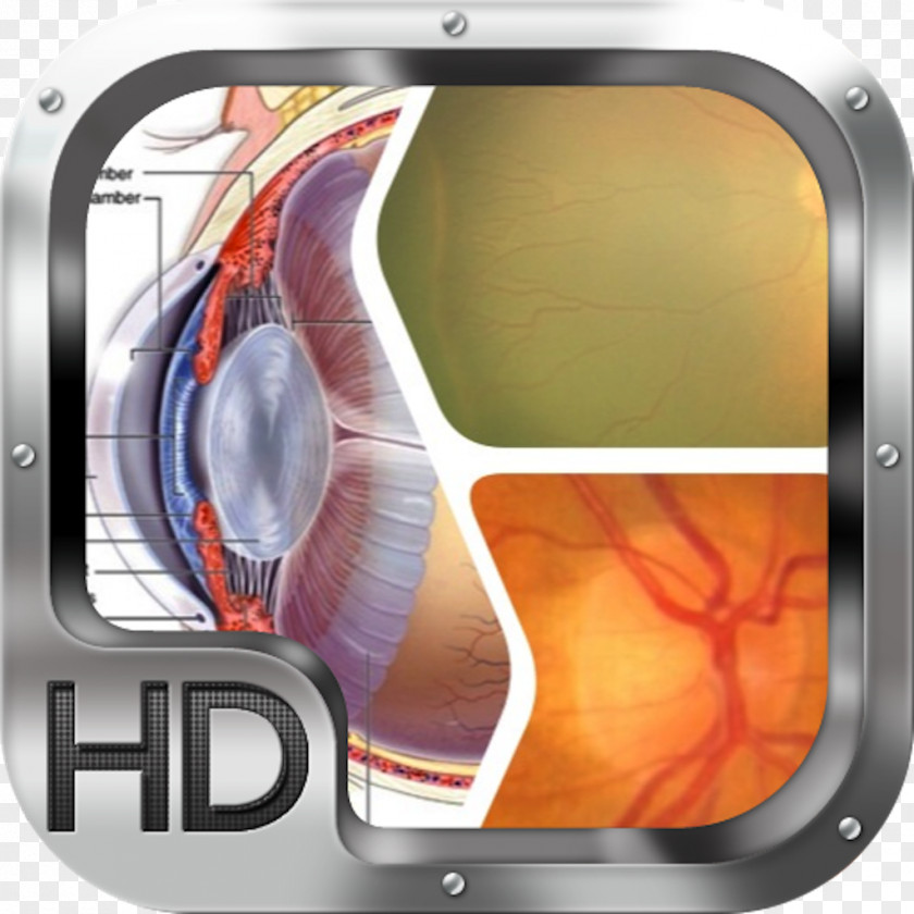 Eye Human Cataract Visual System Sense PNG