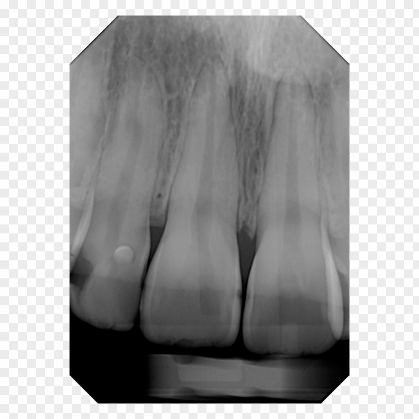 X Ray Unit Digital Radiography X-ray Dental Cone Beam Computed Tomography PNG