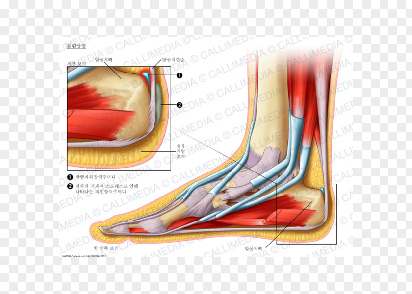 Foot Bursitis Synovial Bursa Elbow Knee PNG