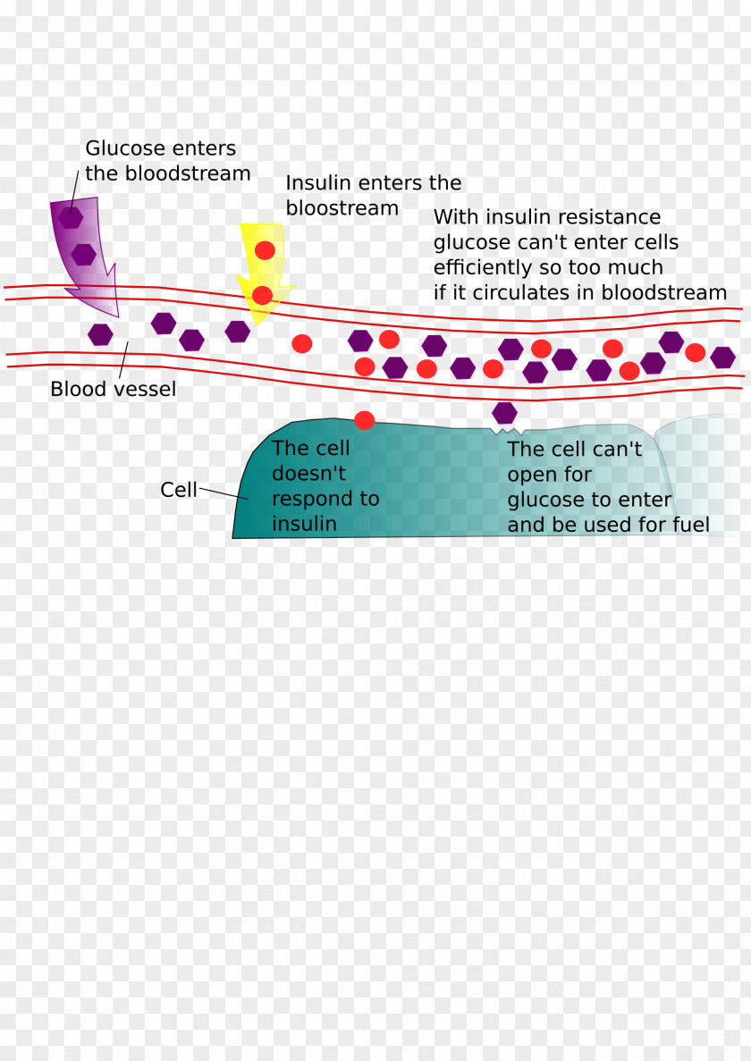 Insulin Resistance The Sun, Rain, And Insulin: Growing Up With Diabetes Mellitus Pump PNG