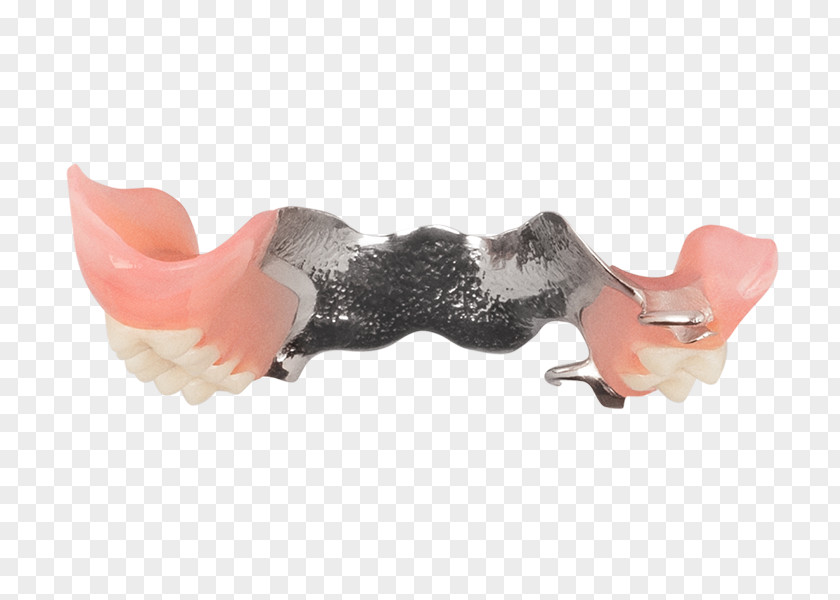 Aspen Dental Removable Partial Denture Dentures Dentistry Lazada Indonesia PNG