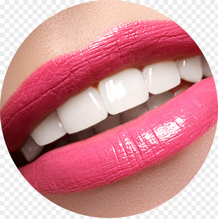 Toothpaste Tooth Whitening Dentistry Dental Braces PNG