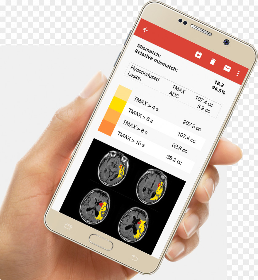 Smartphone La Ciotat Olea Medical Perfusion MRI Mobile Phones PNG