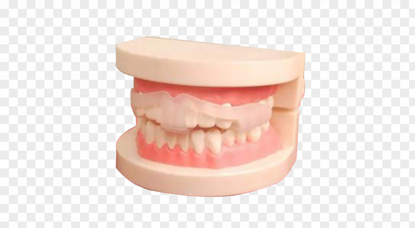 Braces Model Material Tooth Dental Cosmetic Dentistry PNG