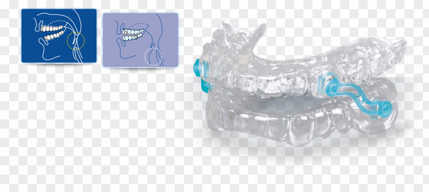 Open An Account Freely Snoring Dentistry Apnea Upper Airway Resistance Syndrome PNG