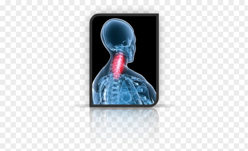 Dard Neck Pain Riluzole Drug Osteochondrosis PNG