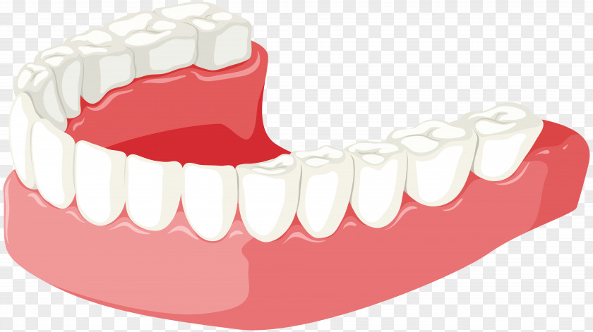 Dent Tooth Jaw Dentures Clip Art PNG