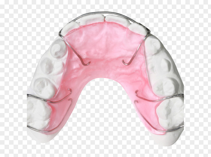 Retainer Orthodontics Orthodontic Technology Jaw Bionator PNG