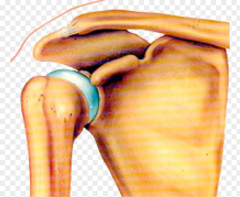 Arm Joint Dislocation Shoulder Bone PNG
